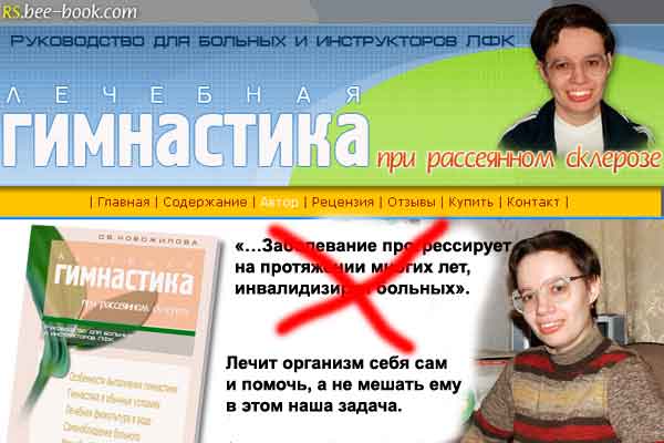 Лечебная гимнастика при рассеянном склерозе.